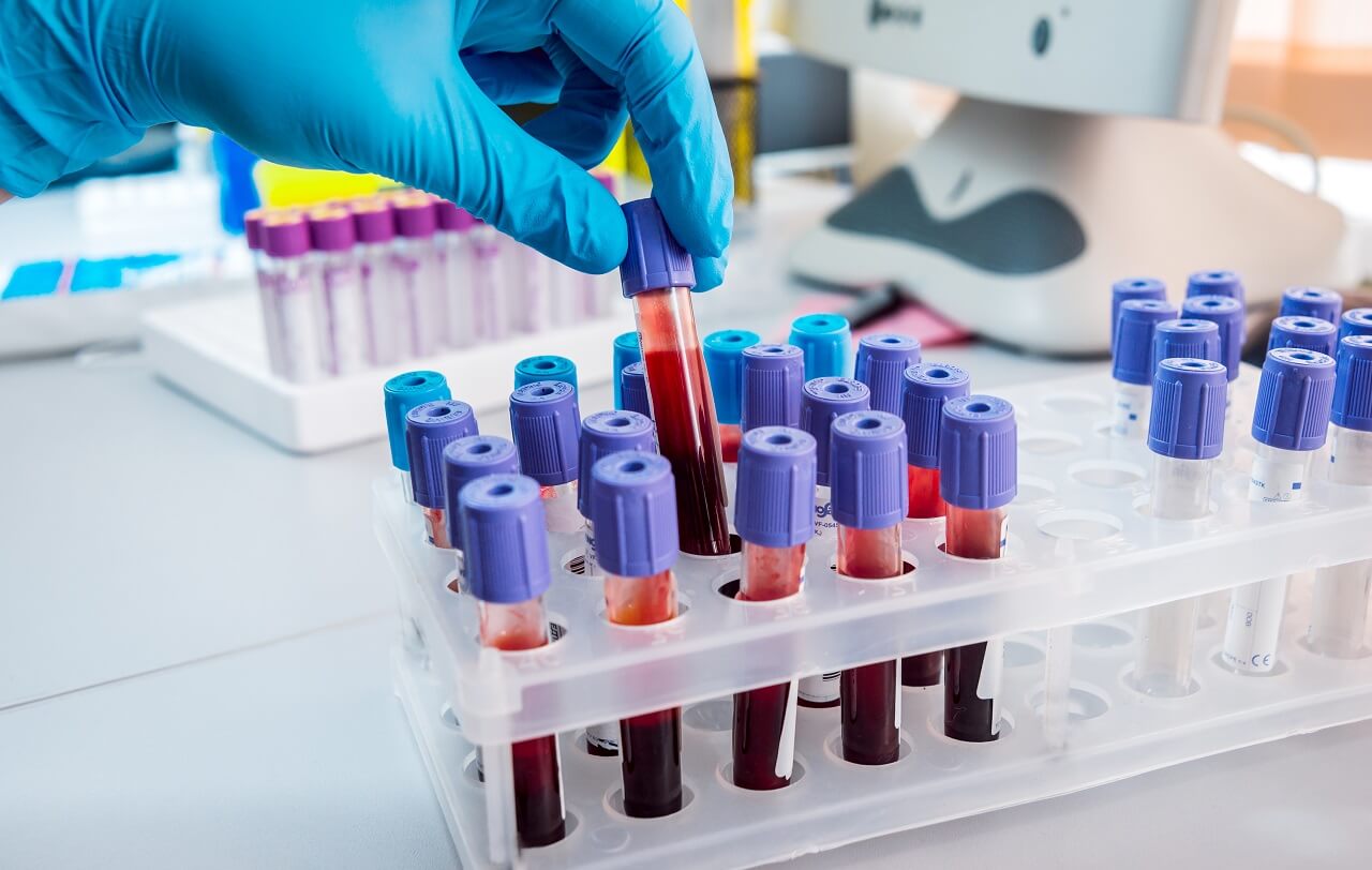 Лабораторные анализы