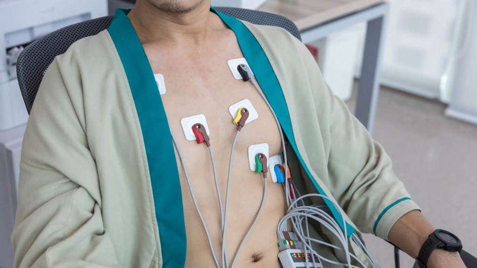 Холтеровское мониторирование ЭКГ